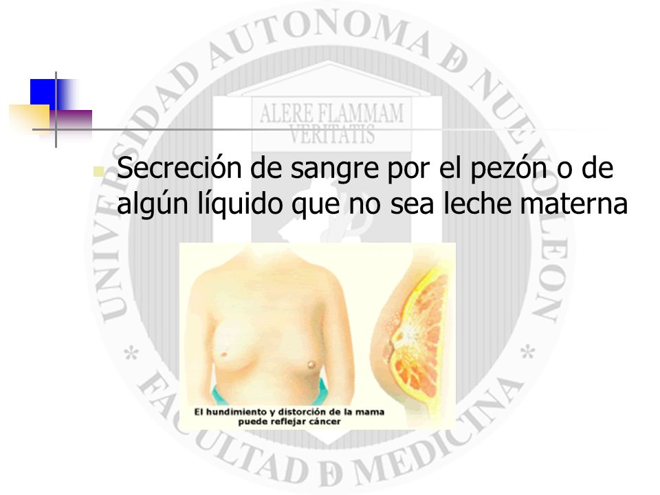 Sangre en el pezon